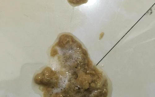 請問貓咪嘔吐的原因及處理方法？