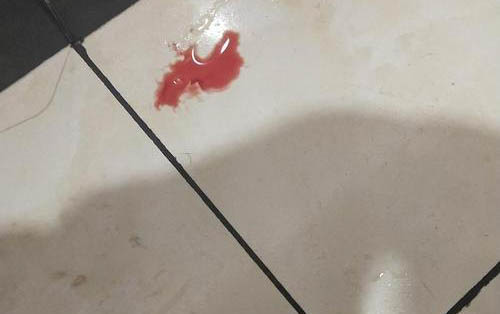 貓拉稀怎么辦?貓咪滿地打滾還叫喚怎么辦?