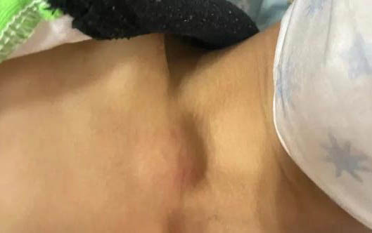 狗狗產后消炎方法
